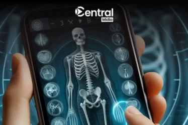 Aplicación de rayos X gratis en el celular