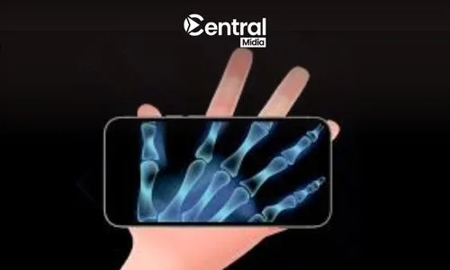 Aplicaciones para consultar radiografías