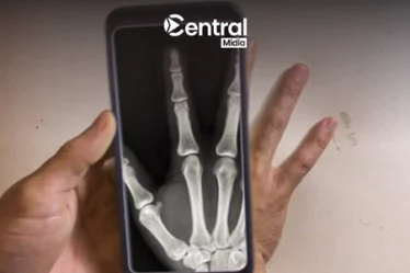 Mejores Aplicaciones de Rayos X para el Celular