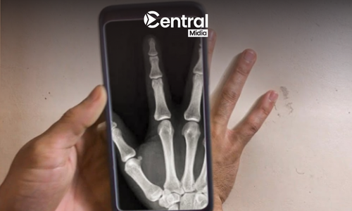 Mejores Aplicaciones de Rayos X para el Celular