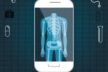 Mira tu radiografía en el celular – ¡Descubre cómo!