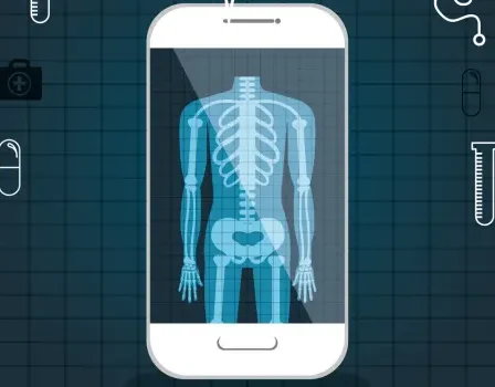Mira tu radiografía en el celular – ¡Descubre cómo!