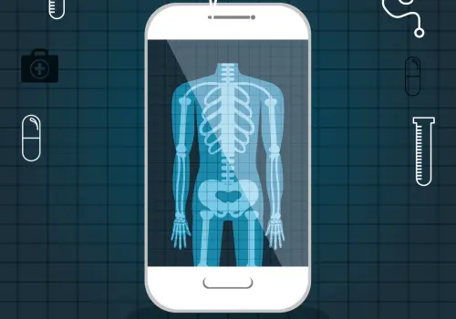 Mira tu radiografía en el celular – ¡Descubre cómo!